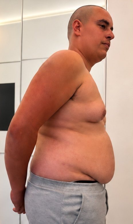 Yair before, 118 kg